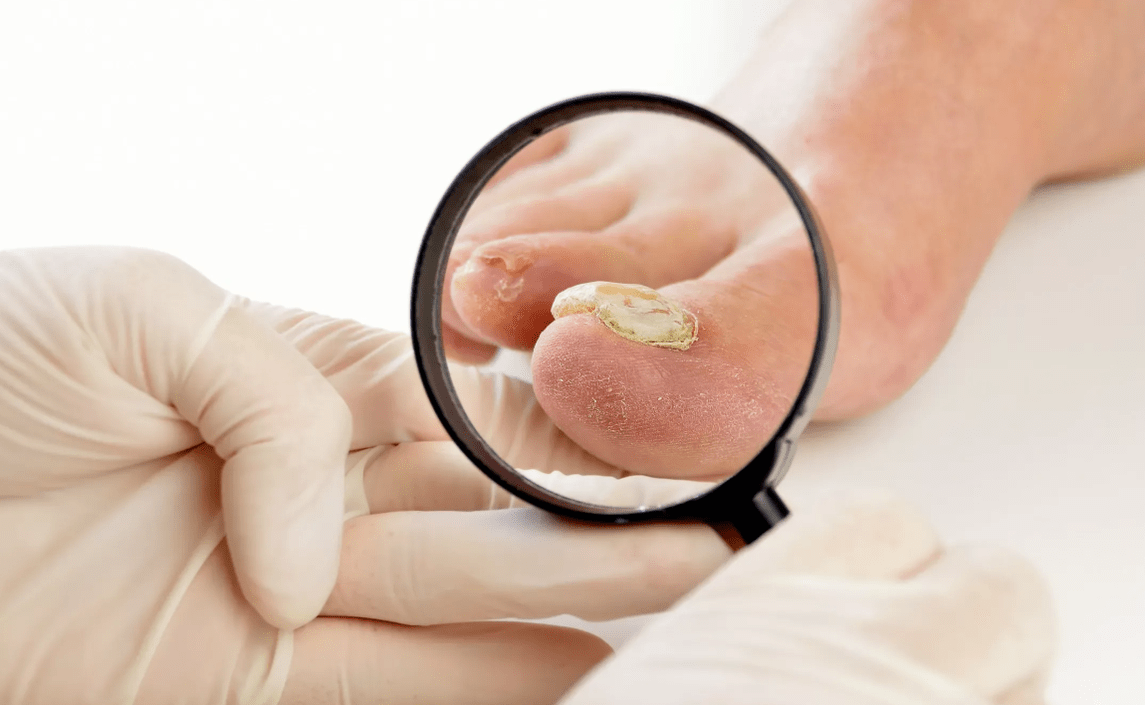 Diagnosi